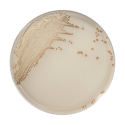 Thermo Scientific Spectra Candida Agar 90 mm plate | Buy Online | Thermo Scientific&trade; | Fisher Scientific
