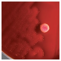 Thermo Scientific™ PYR/Esculin Disc