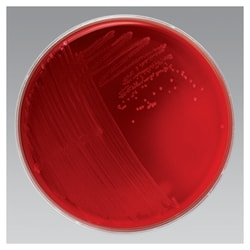 Thermo Scientific™ Anaerobic Reducible Blood Agar