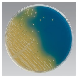 Thermo Scientific™ Candida BCG Agar