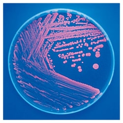 Thermo Scientific™ Porphyrin Test Agar