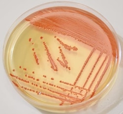 Thermo Scientific™ Spectra™ Strep A Agar