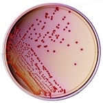 Thermo Scientific™ Yersinia Selective Agar